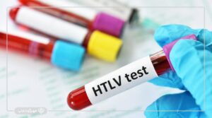 آزمایش HTLV چیست؟