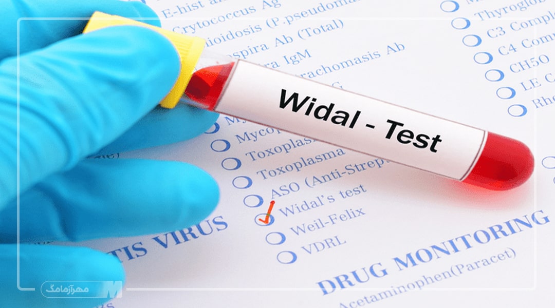 آزمایش ویدال چیست؟