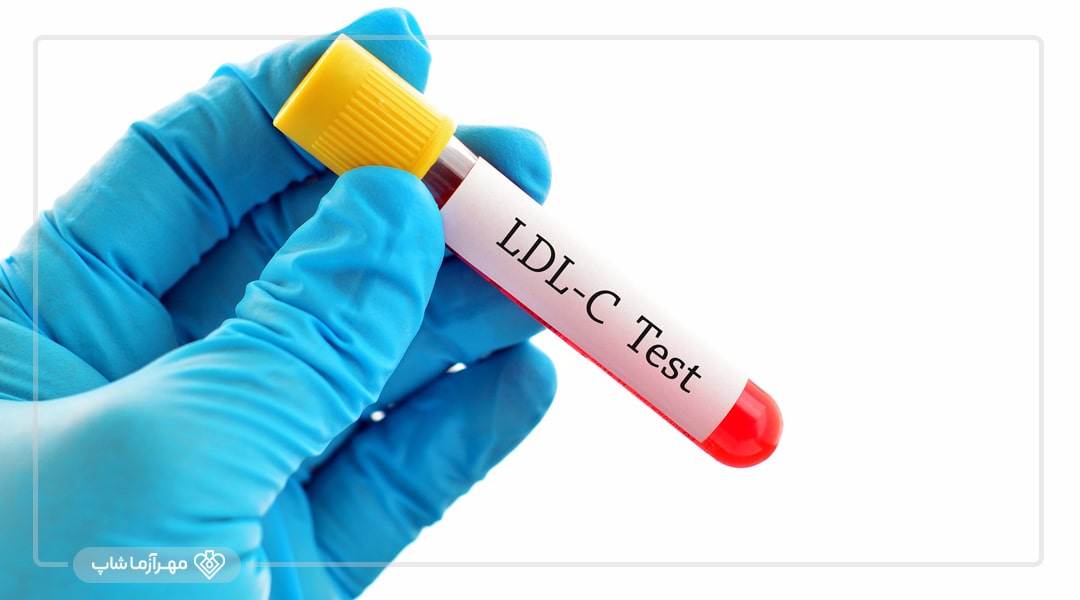 آزمایش LDL یا تست کلسترول