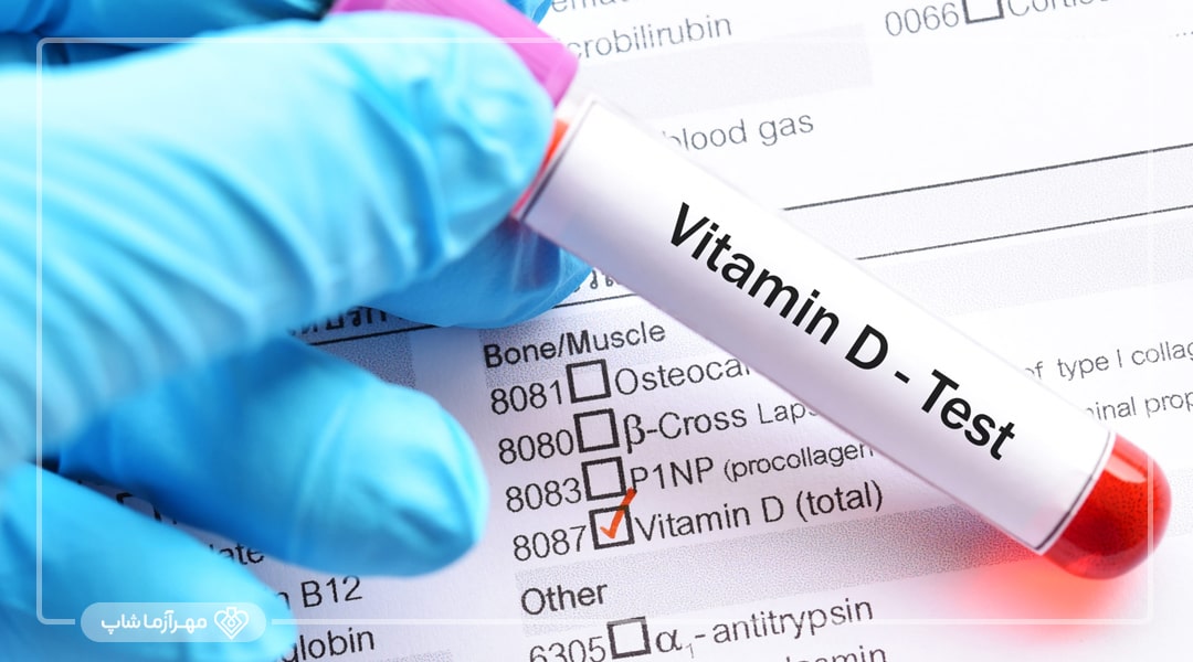 آزمایش ویتامین D چیست؟